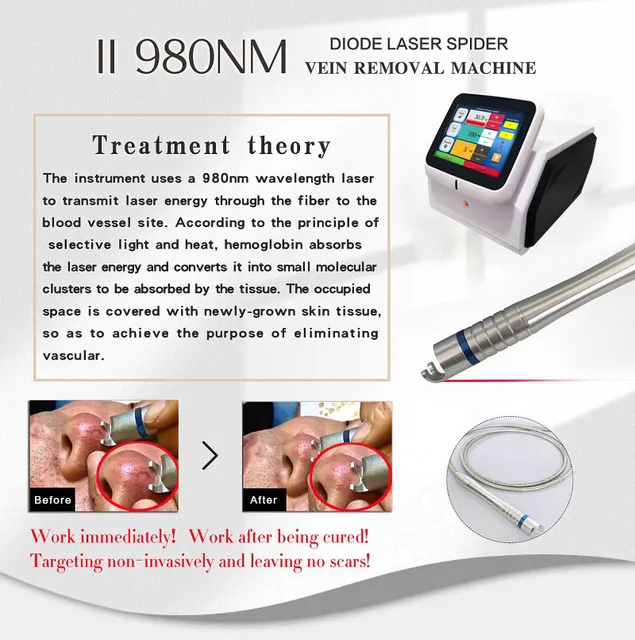 980 nm Diode Vascular Laser – 40 W ? product detail