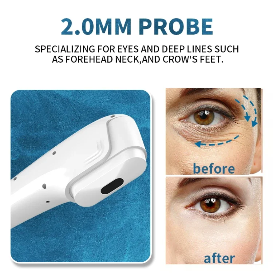 7D HIFU Machine – Compact ? product detail