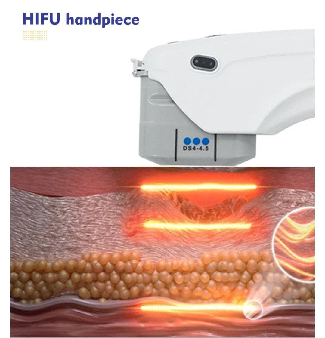 HIFU Treatment Handpiece